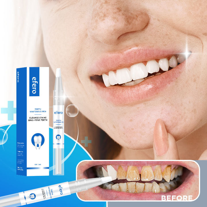 (40% OFF) Teeth Whitening Pen