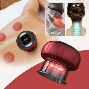 (1 + 1 FREE) Smart Cupping Therapy Massager