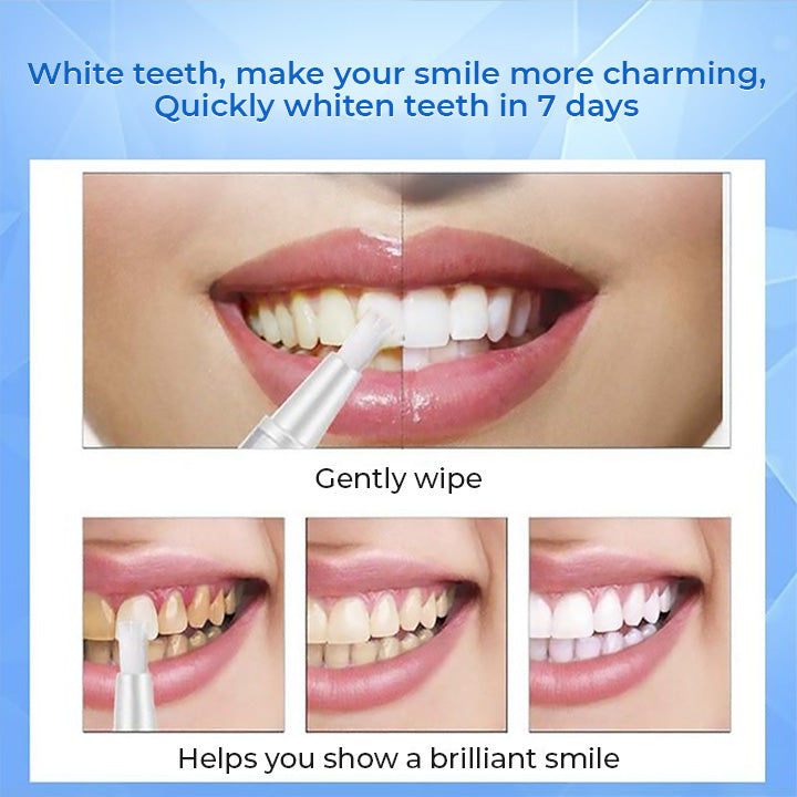 (40% OFF) Teeth Whitening Pen