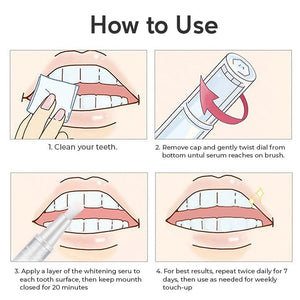 [40% OFF] Teeth Whitening Pen